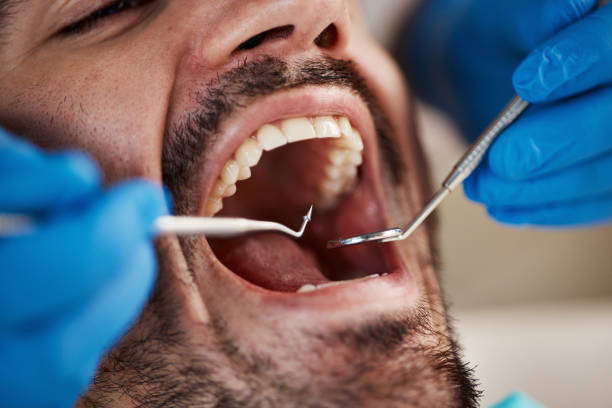 Best Emergency Denture Repair in Inwood, FL