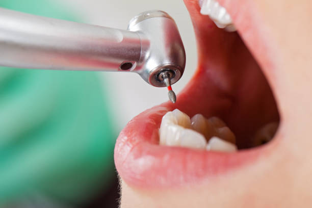 Best Cosmetic Emergency Dentistry in Inwood, FL